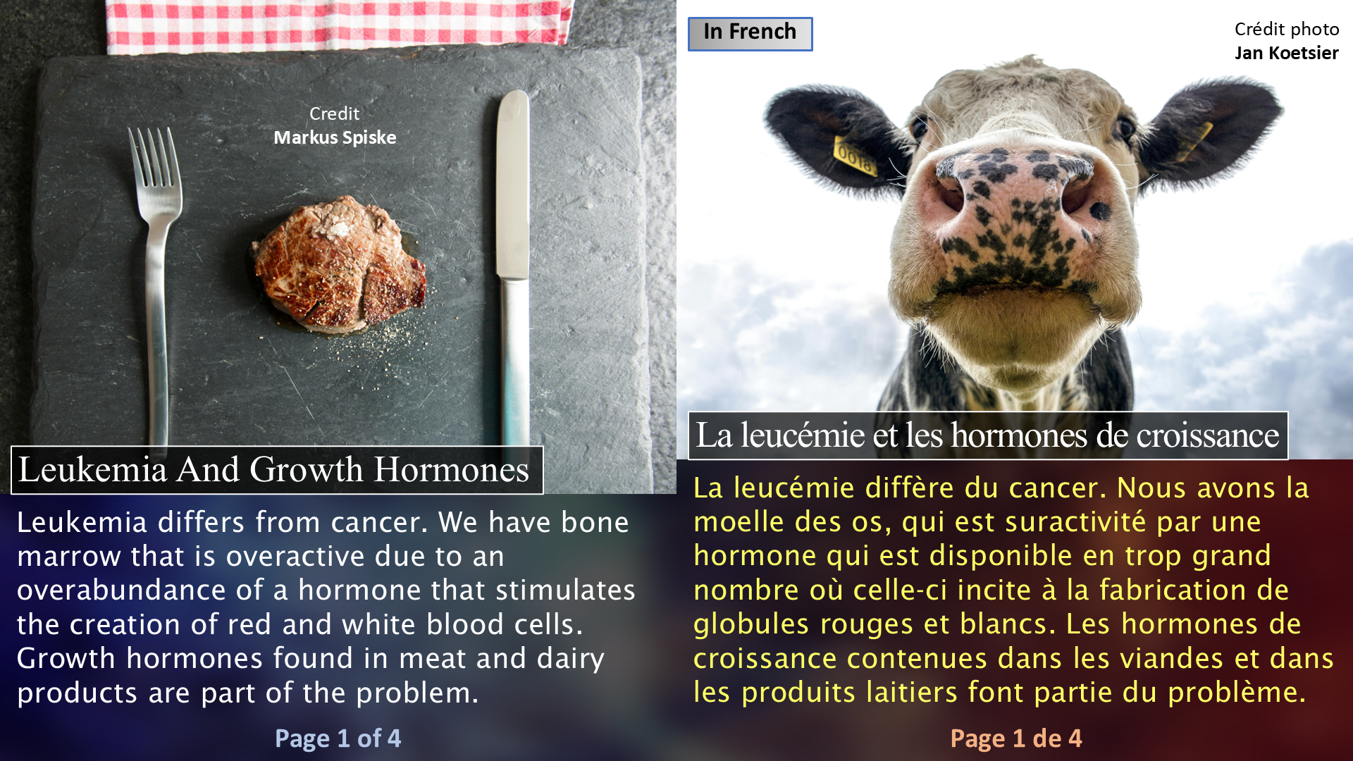 Leukemia and Growth Hormones / La leucémie et les hormones de croissance - Page 1