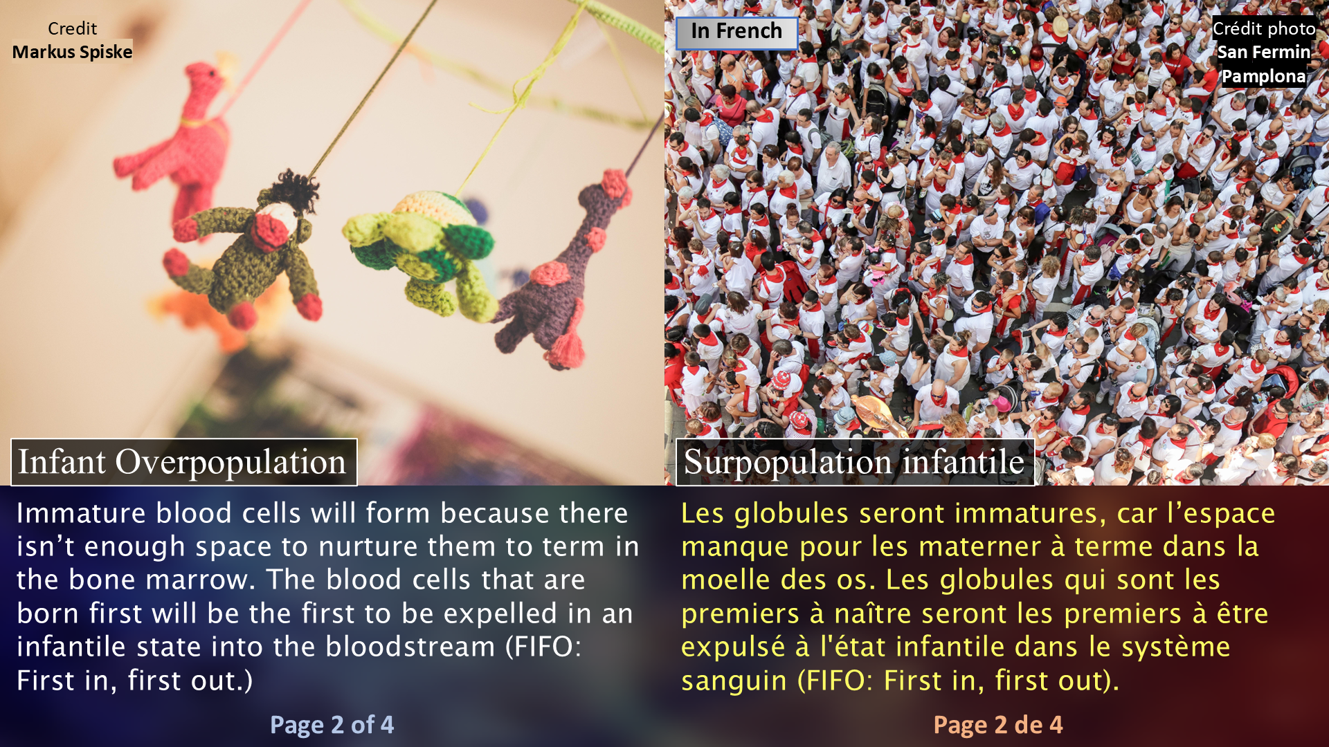 Leukemia and Growth Hormones / La leucémie et les hormones de croissance - Page 2