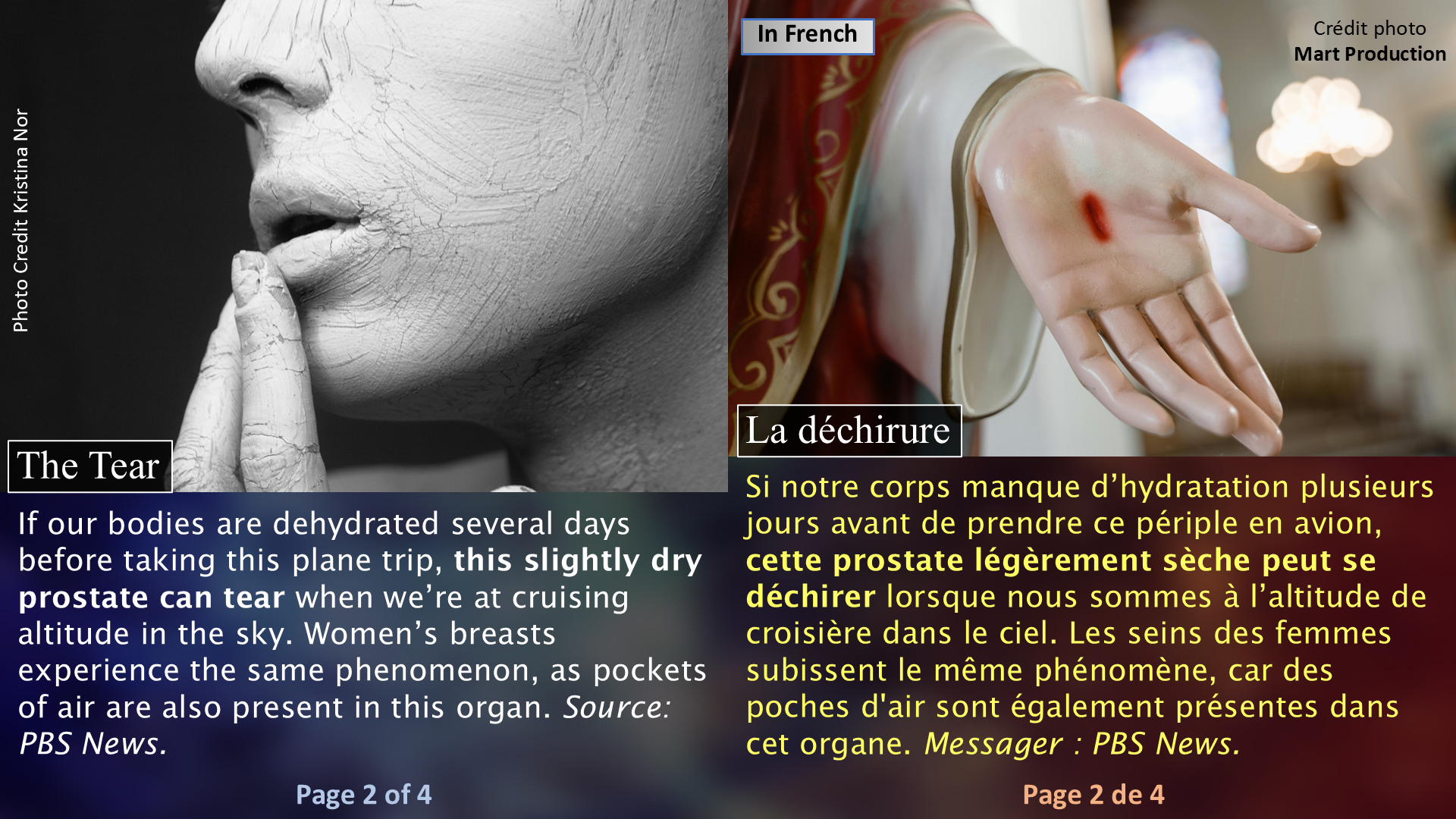 Breast and Prostate Cancers: The Plane / Le cancer du sein et de la prostate : l’avion - Page 02